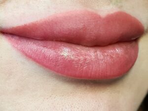 nachher-lips